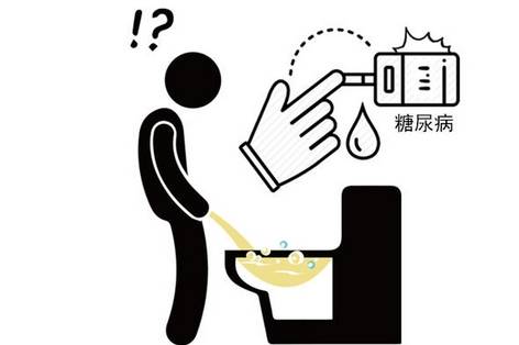 治療|糖尿病患者，尿液有泡沫需警惕！做好這些預防糖尿病腎??！