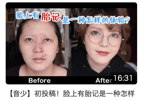 带着满脸疤痕的我，做了美妆博主