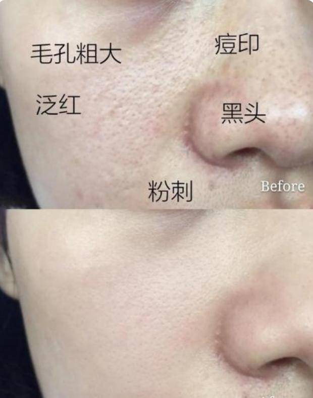 方法李小冉分享的护肤方法，自用“洁面皂”走红，虽便宜但好用