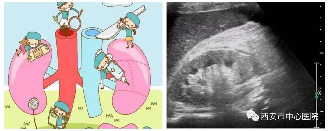 医学科|这帮彩超医师为了糖友，也是拼了！