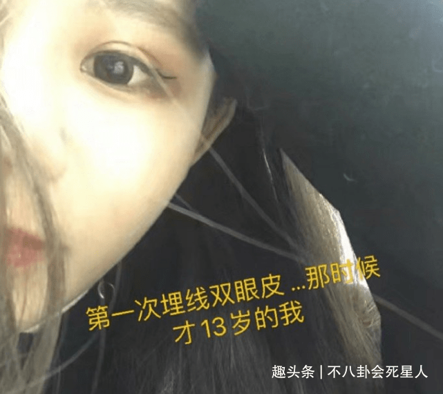 因为00后网红整容成瘾，13岁开整花费百万，整成惊悚脸想选秀出道