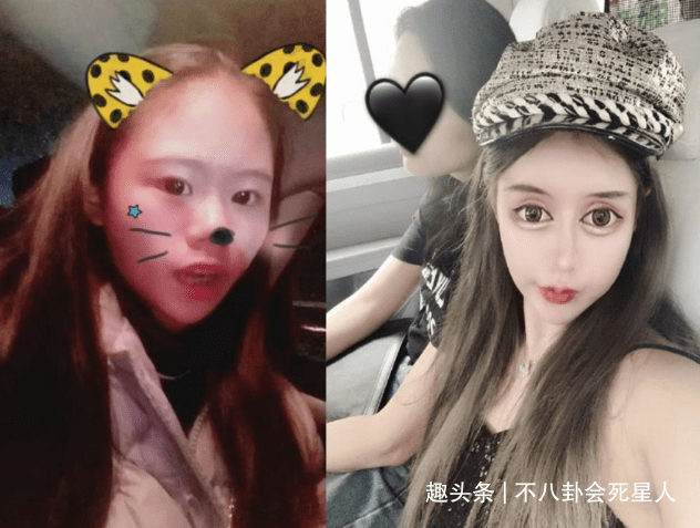 因为00后网红整容成瘾，13岁开整花费百万，整成惊悚脸想选秀出道