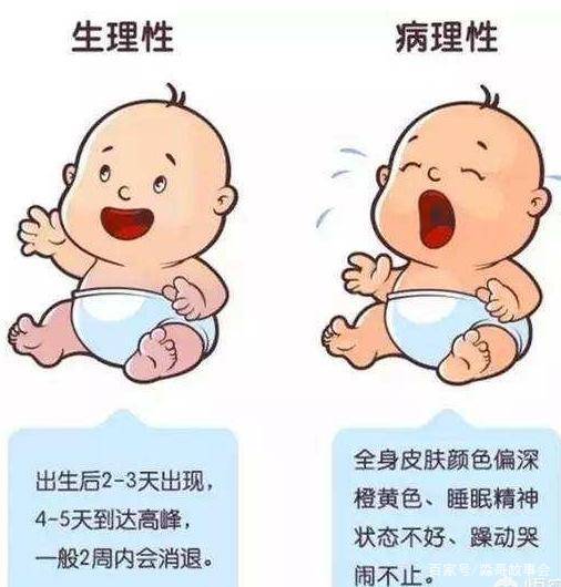 孩子黄疸怎么办