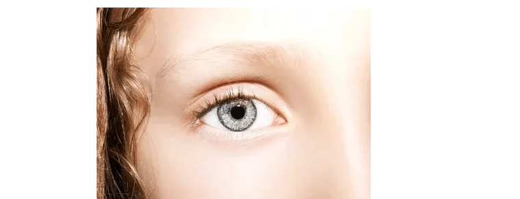 严重|卢老健康课堂:发现睁眼困难、眼睑下垂谨慎—眼肌型重症肌无力！