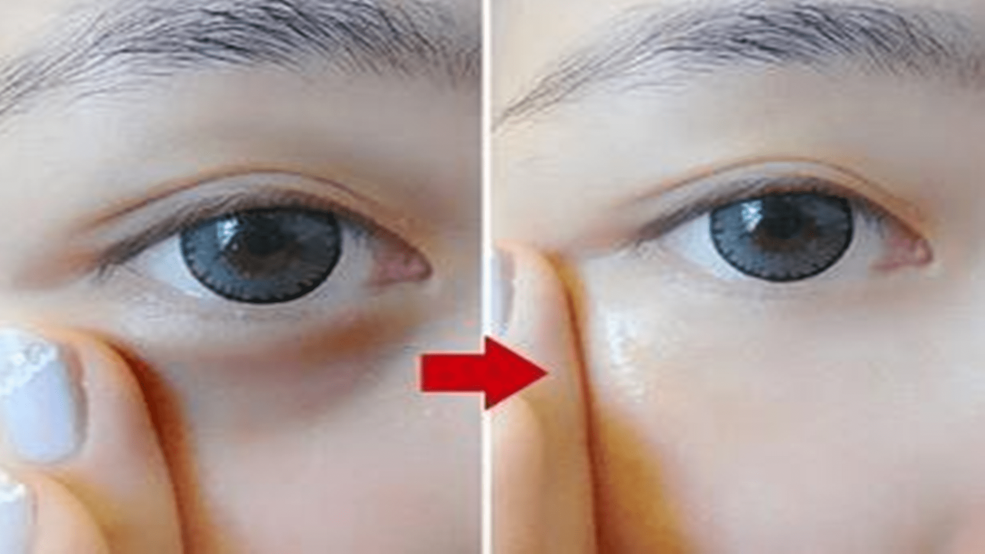 年轻人|黑眼圈门诊，你有兴趣吗？网友的评论亮了