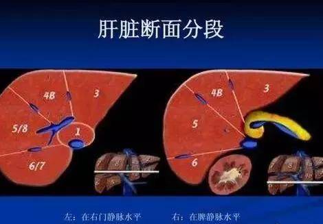 肝脏|患者不明白做CT如何看肝硬化，CT检查对于肝硬化确诊有什么帮助？