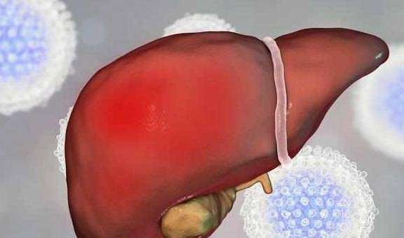 进行|肝不好时，可能有“3黄2臭”的表现，远离“4怕”，肝会一天天好