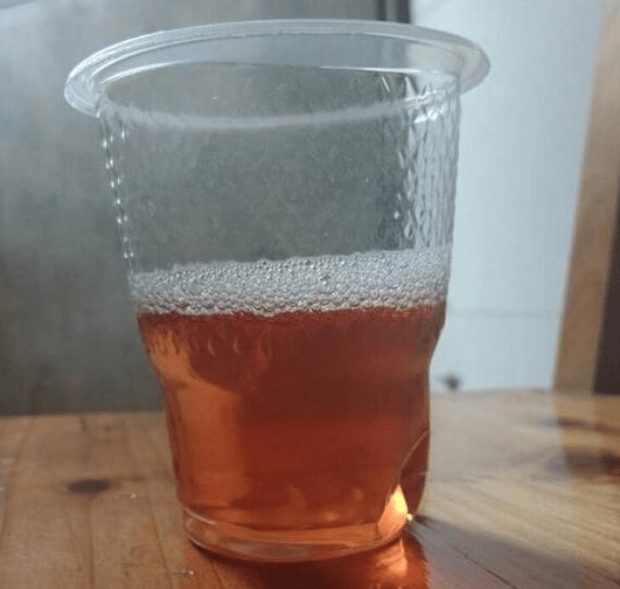 症状|男性晨起3个异常，肝脏或已“烂如蜂窝”，占一个，尽早查肝CT