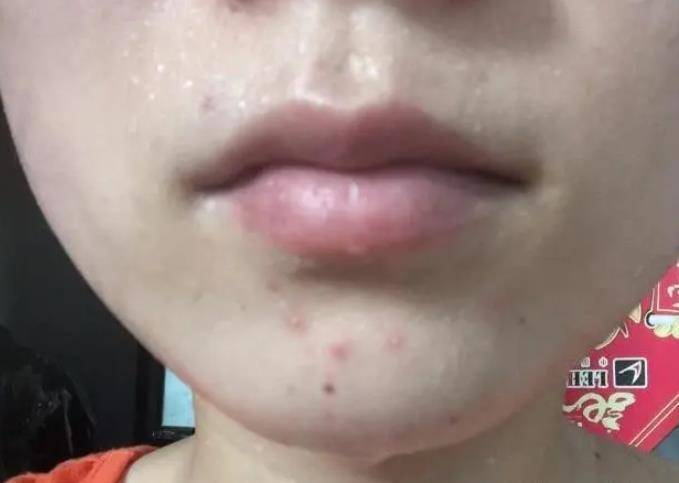 治疗|人体中常见的疾病