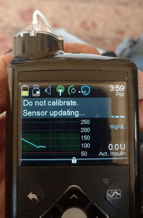 血糖|美敦力胰岛素泵：“人工胰腺”控糖黑科技，为糖友带来巨大的帮助