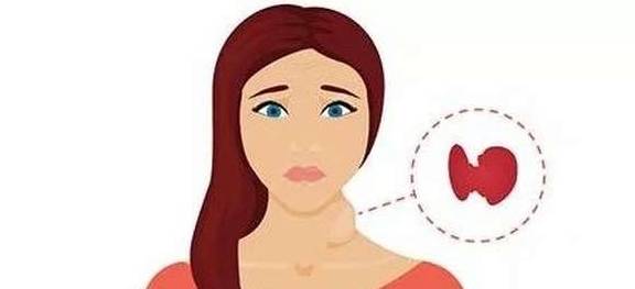 甲减能吃碘的东西吗 37fe9f18910d48ad9b56f43b33c827a1.jpeg