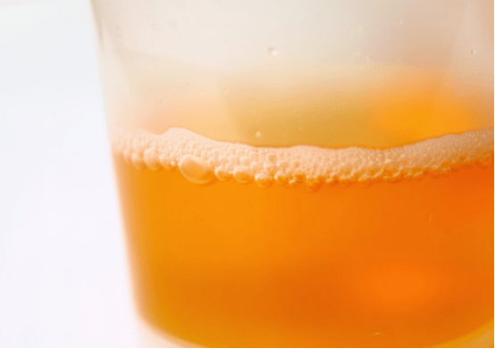 严重|男性晨起3异常，肝脏或以“烂如蜂窝”，一个不占，说明肝脏还算健康