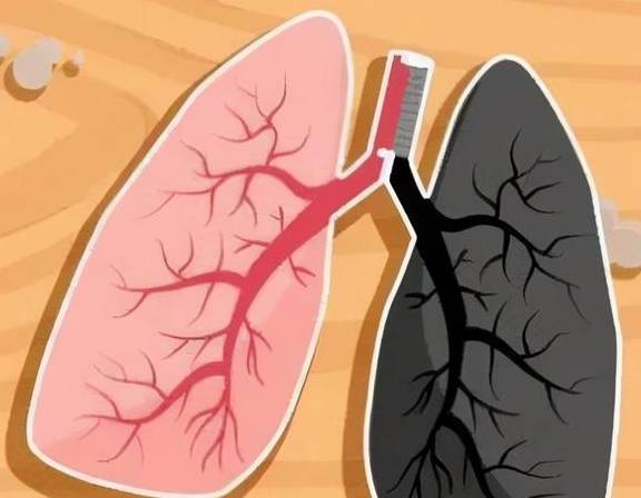 心功能|这种疾病须吃“高脂饮食”!近年来高发,要警惕