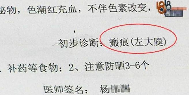 因为女子花53000抽脂整形，大腿留下17厘米疤痕，怒曝光：大猪腿似的