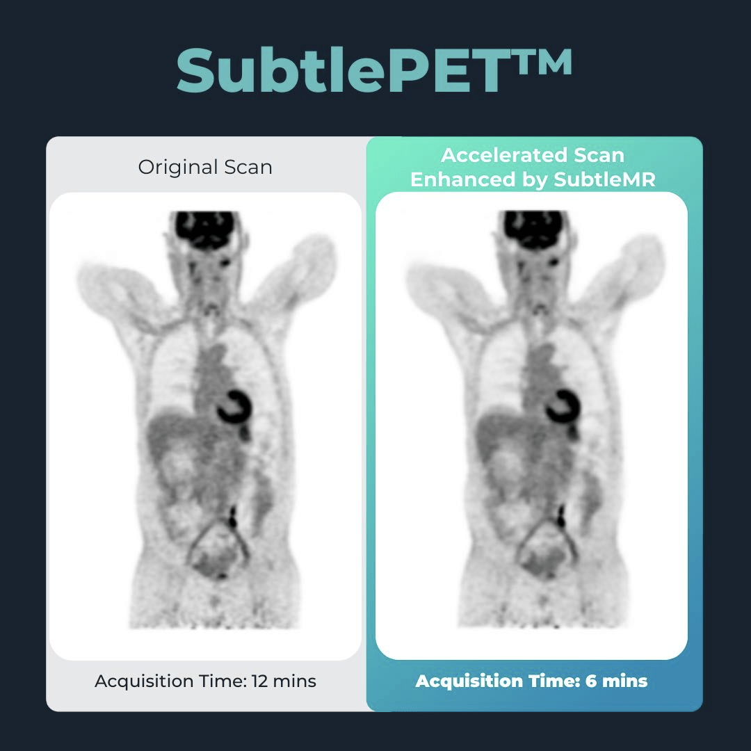与拜耳、西门子合作，深透医疗落地AI医疗全新商业模式