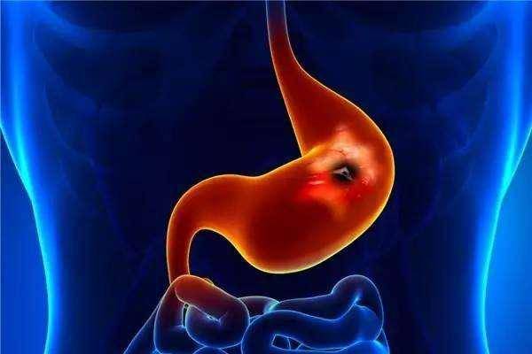 丁香|胃不好,往往有3“坏习惯”,3件事坚持做,胃可能会“感激”你