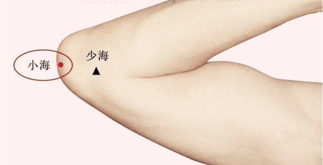 什么穴位不能针刺 2f98ba3370c8407db95e0a733e8dc991.png