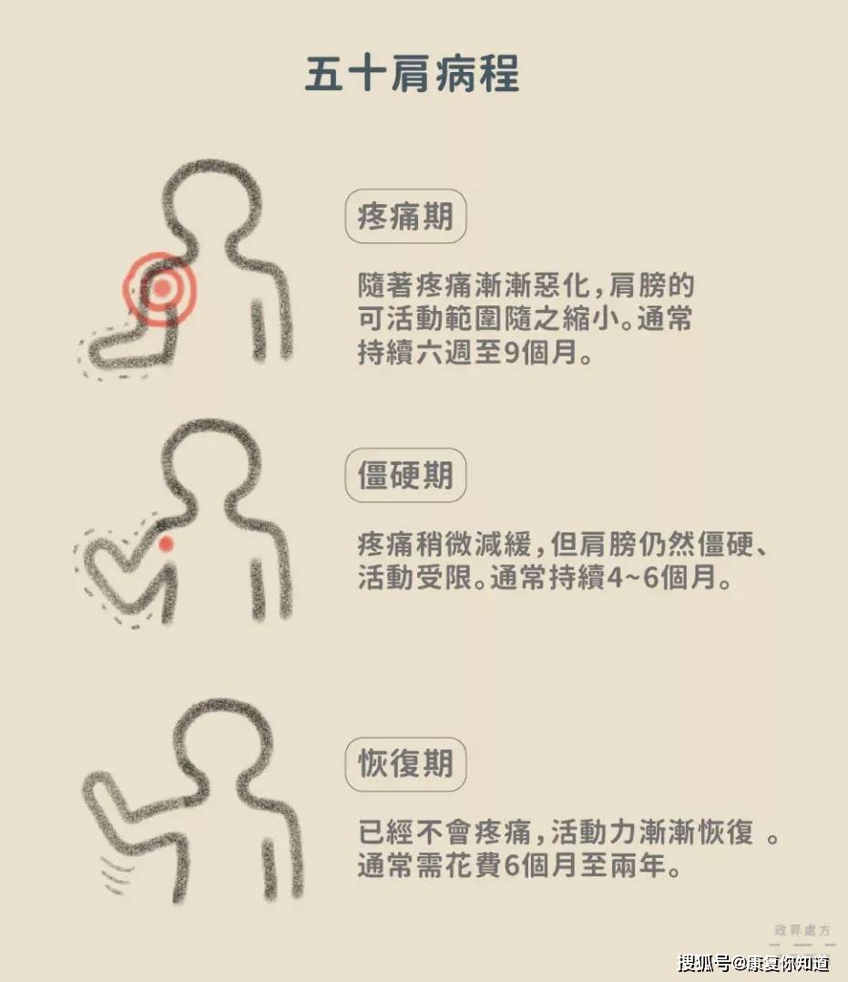 肩周炎的六个压痛点图片