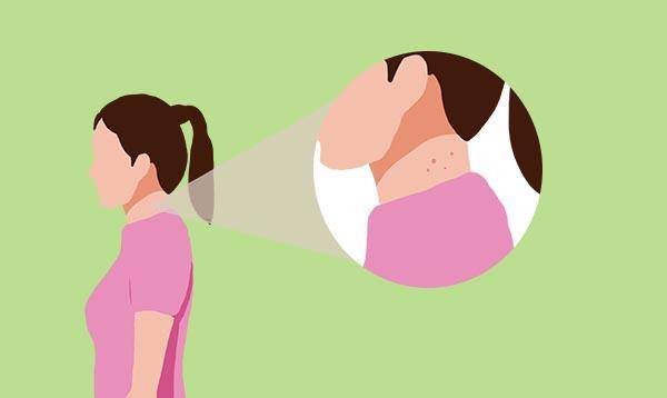 变化|脖子有两大特征,别忽视,或是提醒你血糖升高