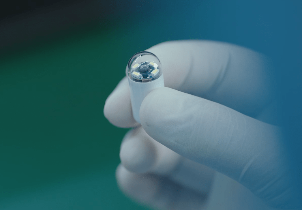 做胃镜害怕,不做又担心胃有问题?来看这一篇_检查_胶囊_磁控