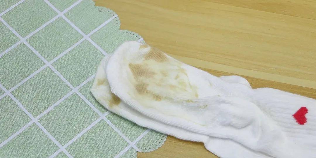 洗白袜子只需涂点这个冲一下立马跟新的一样