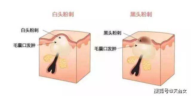 71339a9763d2471da545ccac99dd83c2.jpeg