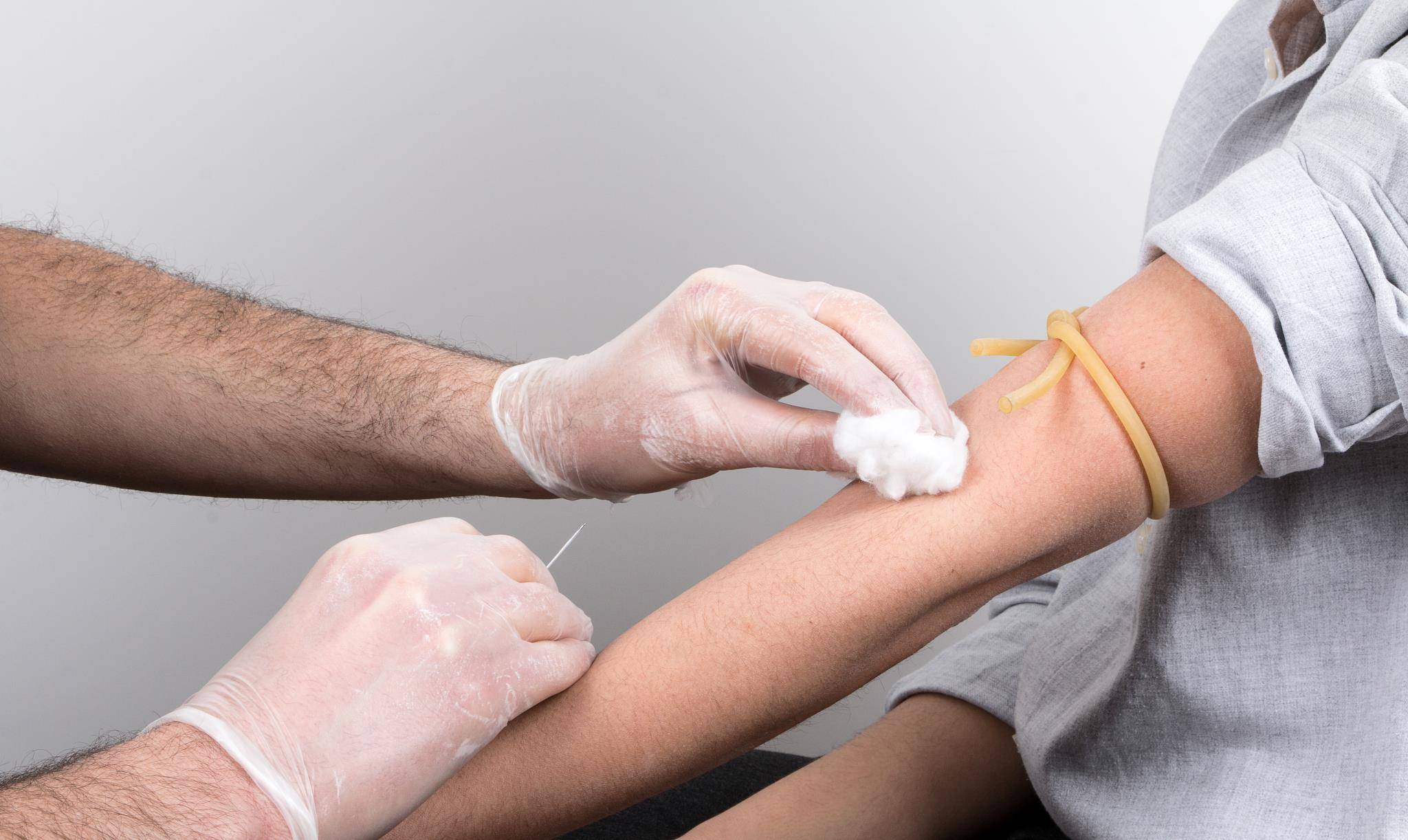 补充|得了肾结核,该做好这几个护理,帮身体减轻负担