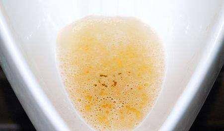 尿酸|尿酸超标的人，若身体出现3种“变化”，或许是肾衰竭找上门