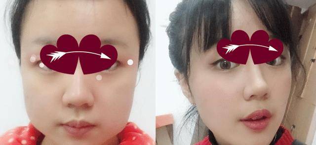 变化那些削骨“一刀切”的明星还好吗？有的已垮掉，小方脸成最后赢家