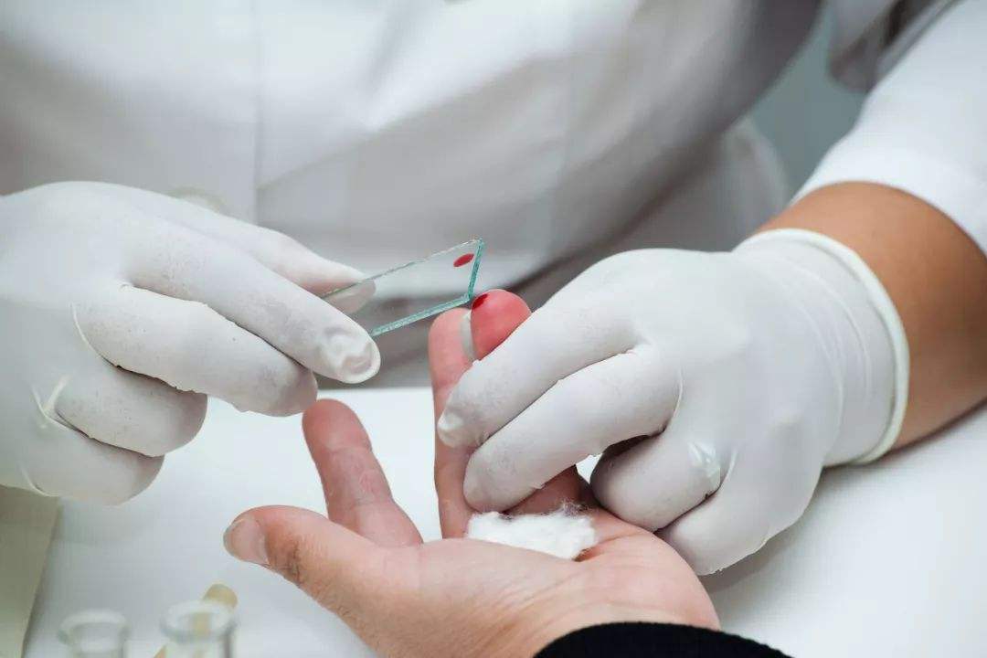 空腹|自测血糖不准?5个细节不能忽视,祖医堂:测血糖黄金时刻要牢记