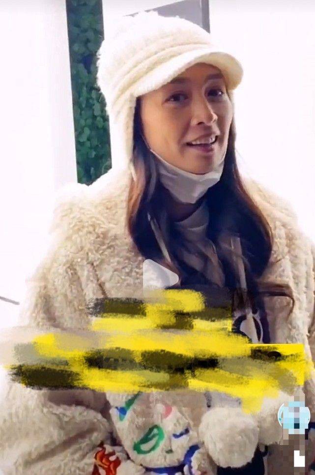头发 这才是51岁真实的张庭，膝盖有点钙化，一看就是老年人的腿！
