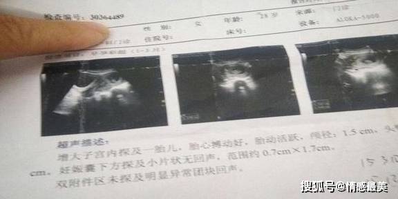 怀孕多久可以查到孩子健康 554615daa44448b3bb2bbea4f792d7e2.jpeg
