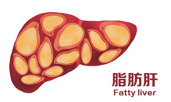 严重|肝害怕的行为，大多在饭后、睡前发生，若你天天做，肝能好才怪