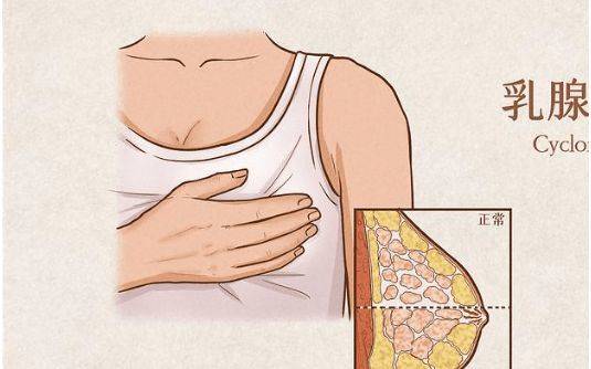 乳腺肿块乳腺疼痛等疾病离乳腺癌有多远广州和谐谢春花主任告诉你