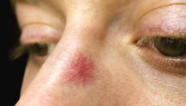 毒素|肝脏开始变硬,身体会露出哪些“破绽”?