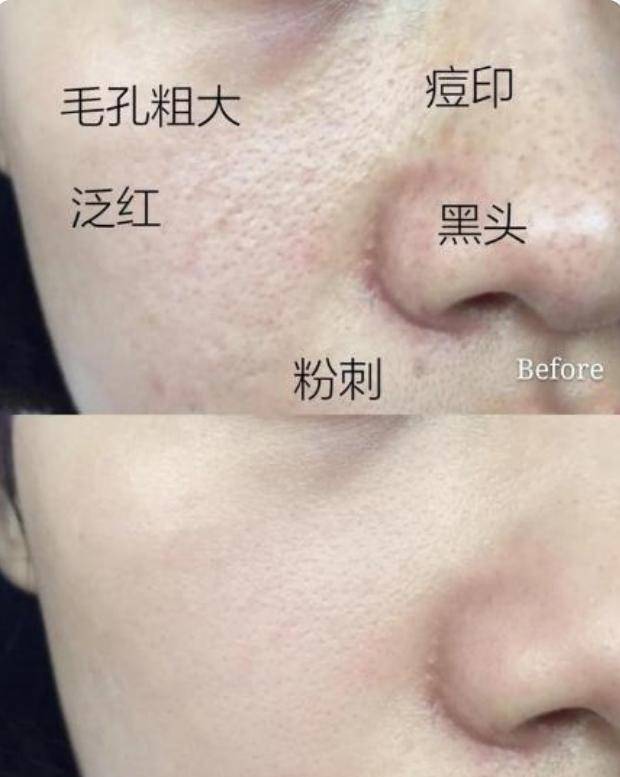 美眉为何韩国女生普遍都是“冷白皮”？坚持3个好习惯，肌肤焕白通透