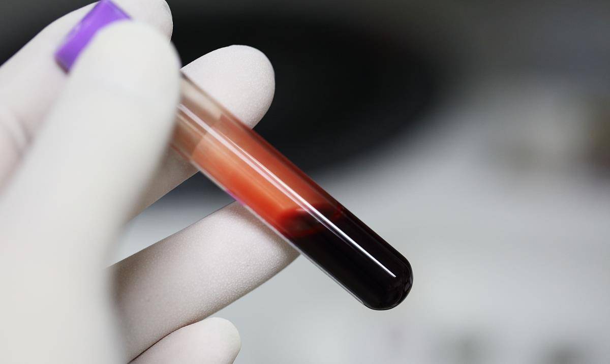 治疗|给慢性肾衰患者提个醒：掌握好这5个要点，避免治疗走弯路