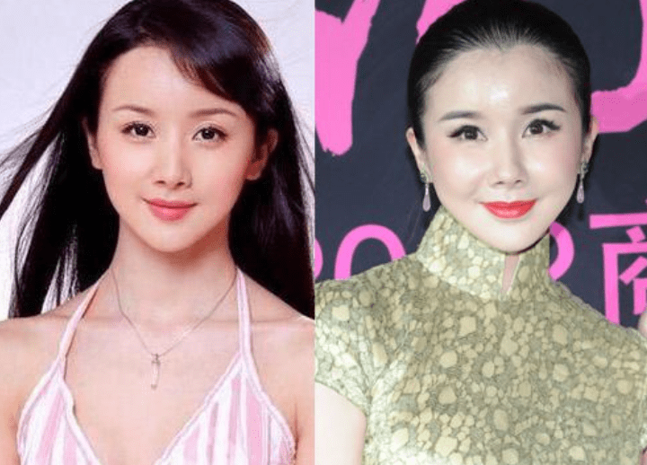 后遗症那些乱整鼻子的女星还好吗？后遗症一大堆，杨幂金晨都开始崩了