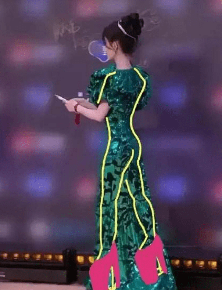 后遗症那些乱整鼻子的女星还好吗？后遗症一大堆，杨幂金晨都开始崩了