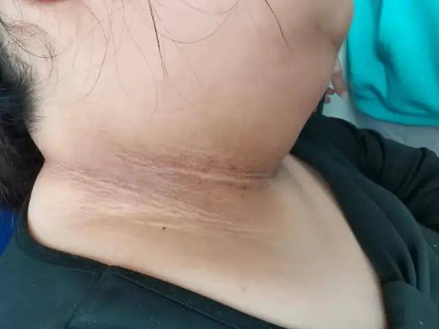 寻找|「案例」“丈夫背着我从重庆到广州，只为寻找王存川教授团队”