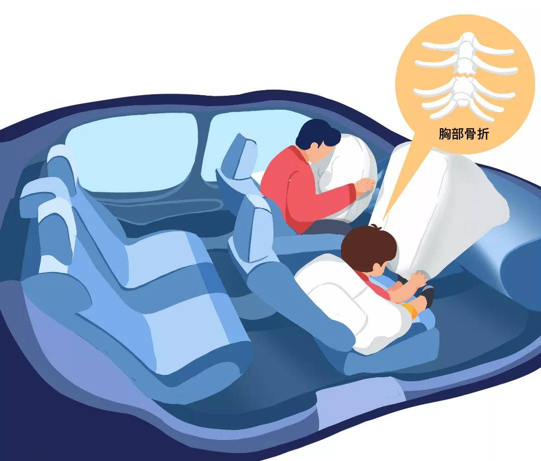 对于成人来说,安全气囊和安全带能给身体带来最佳保护,但是对于儿童来