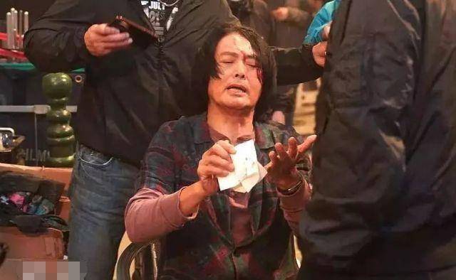 因为|周润发受伤缝5针仍坚持拍戏,而这10位明星也很敬业:这才叫演员