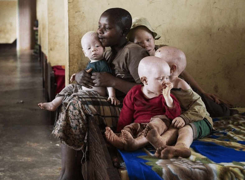 非洲版唐僧身体被人觊觎血液堪比黄金遗骸能卖上百万