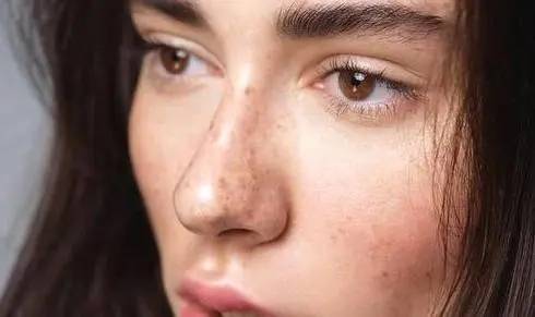 美容贝颜美容|长了黄褐斑的女人，要了解这些
