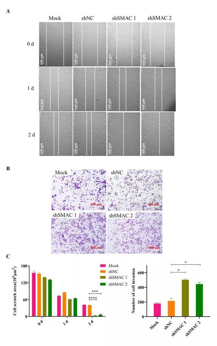 恶性肿瘤|【shRNA慢病毒文章分享】Bioactive Materials ‖湖南大学胡小晓团队揭示核…