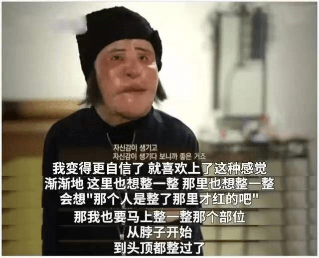 美貌整容狂人韩慧景：昔日美貌如花，整容后事业全毁，57岁遗憾离世