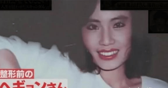 美貌整容狂人韩慧景：昔日美貌如花，整容后事业全毁，57岁遗憾离世