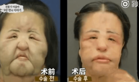 美貌整容狂人韩慧景：昔日美貌如花，整容后事业全毁，57岁遗憾离世