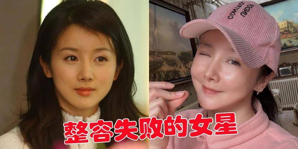 对比整容后遗症有多可怕？中美韩明星脸部塌房对比图，有些脸都认不出