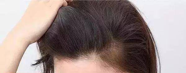 发型被宋祖儿逗笑!遇见粉丝求合影,赶紧去洗刘海,太可爱了